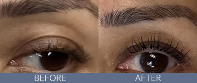 Brow Lamination Before and After, DeSoto, TX