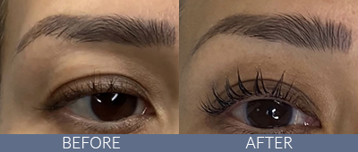 Brow Lamination Before and After, DeSoto, TX