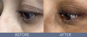 Brow Lamination & Lash Lift Gallery