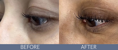 Lash Lift Before and After, DeSoto, TX