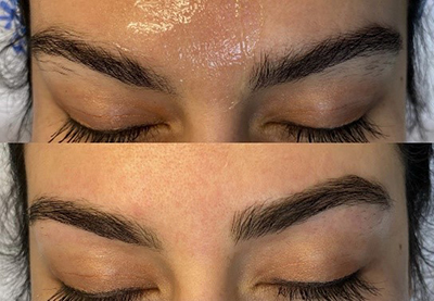 Waxing Dallas Waxing Dallas