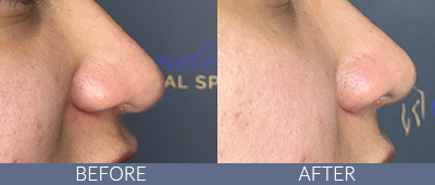 Injectables Before and After, DeSoto, TX