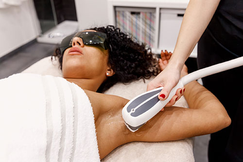 Laser Hair Removal