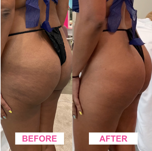 Sculpt & Define: Bioslimming Body Wraps