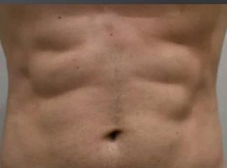 AccuFit After, DeSoto, TX