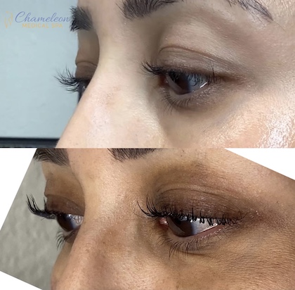 Lash Lift Before and After, DeSoto, TX
